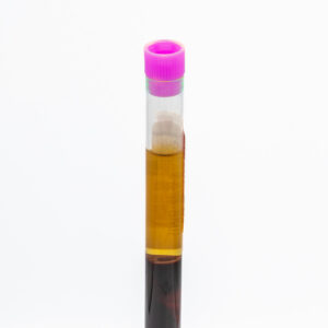 Residual EDTA Tube
