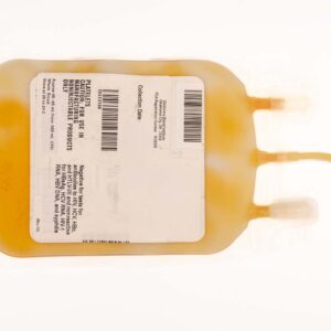 Single-donor “random” Platelet Rich Plasma